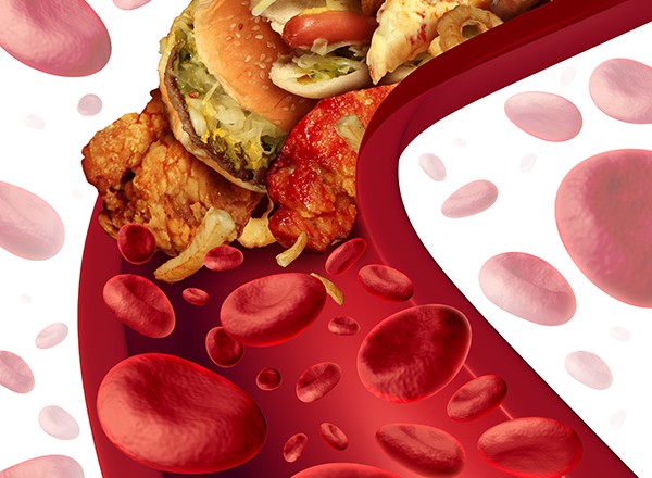 cholesterol 600 pxl